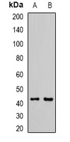 Anti-L2HGDH Antibody