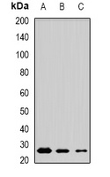 Anti-MSRB3 Antibody
