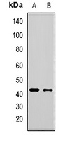 Anti-MBNL1 Antibody