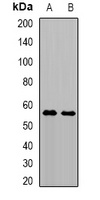 Anti-TRMT61B Antibody