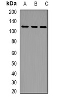 Anti-LLGL2 Antibody
