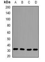 Anti-CapZ beta Antibody
