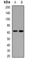 MGAT3 antibody