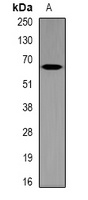 MT-ND5 antibody