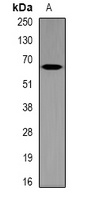 Anti-MT-ND5 Antibody