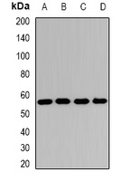 Anti-SCOT Antibody