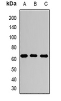 Anti-Sulphamidase Antibody