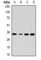 Anti-AKR7A3 Antibody