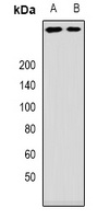 ANKHD1 antibody