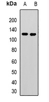 Anti-KANSL3 Antibody