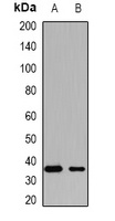 Anti-KCTD15 Antibody