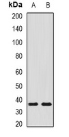 SHOX2 antibody