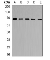 RPN2 antibody