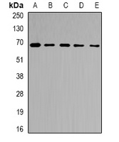 Anti-Ribophorin-2 Antibody