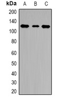 Anti-HLTF Antibody