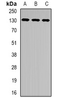 Anti-XPC Antibody