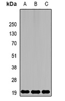 Anti-MsrB2 Antibody
