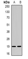 Anti-NUDT15 Antibody