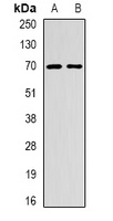 Anti-EME1 Antibody