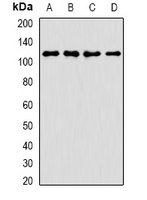 ANKRD52 antibody