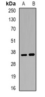 ACP5 antibody