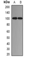 Anti-ADAM9 Antibody