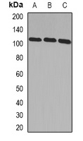 ADAMTS5 antibody