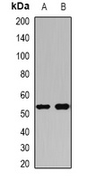 Angiotensinogen antibody