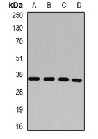 Anti-p43 Antibody