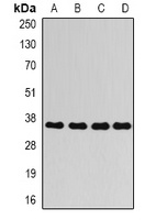 AKR1C4 antibody