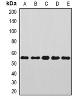 Anti-Annexin A11 Antibody