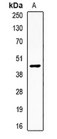 Anti-Apolipoprotein H Antibody