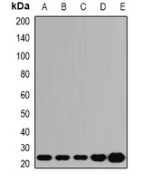 Anti-ATP5O Antibody