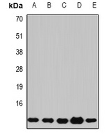 Anti-Beta 2 Microglobulin Antibody