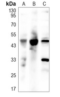BMP15 antibody