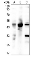 Anti-BMP15 Antibody