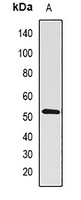 Anti-BMPR1B Antibody