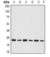 Anti-BNIP1 Antibody