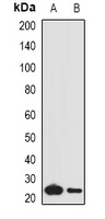 Anti-Complement C1QA Antibody