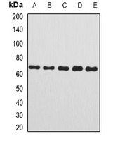 Anti-Complement C8 beta Antibody