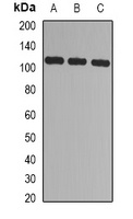 Anti-CBLB Antibody