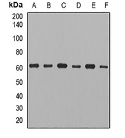 CCT3 antibody