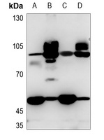 Anti-CD36 Antibody