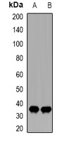 CDK20 antibody