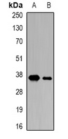 Anti-CDK6 Antibody