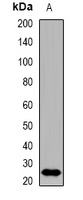 Anti-CDKN3 Antibody
