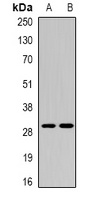 Anti-CEACAM7 Antibody