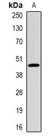 Anti-CFHR1 Antibody