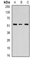 Anti-Chitotriosidase Antibody