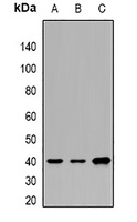 Anti-CNTFR alpha Antibody
